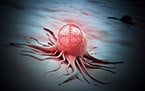 colon cancer, intestinal polyps, tumors, cancer, CtBP, cancer drugs