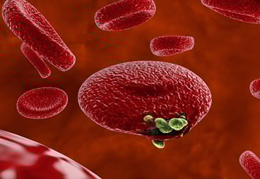The enemy of my enemy is my friend: Plasmodium falciparum, the malaria parasite, abolishes cancer immune evasion and inhibits blood vessel formation in tumor