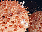 Plasma cells; T reg; autoimmune; immune system