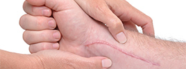 The skin remembers injuries from sticks and stones, can heal recurring wounds faster