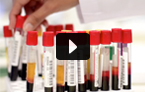 blood test, transfusion, blood testing
