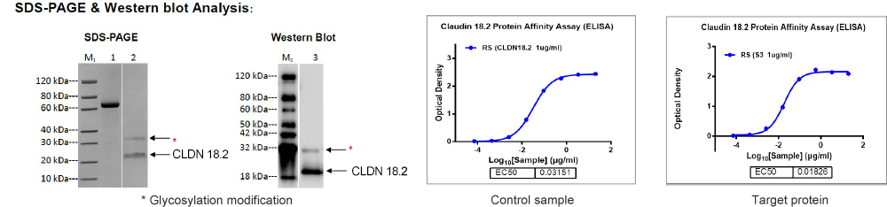 SDS-PAGE & Western blot analysis SDS-PAGE & Western blot analysis