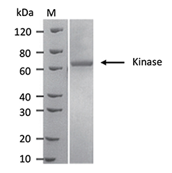 Kinase expression