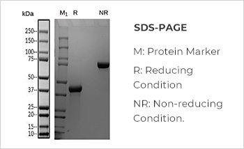 modalImg11