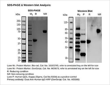 SDS-PAGE & Western blot analysis