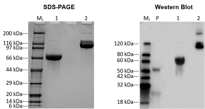 SDS-PAGE and Western blot analysis of S-RBD (mFc-tag)