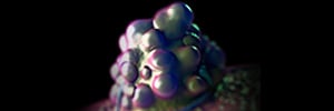 Molecular Classification-based identification of diagnostic and treatment targets in glioma