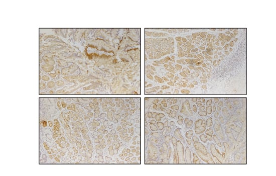 IHC Results of Clone 8 