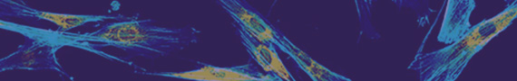 IHC