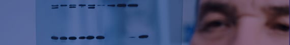 Western Blot & IP