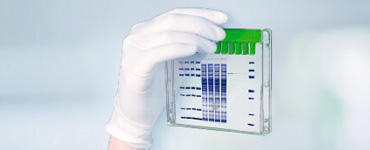 Antigen Expression Test