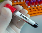 Endotoxin