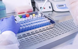Mycoplasma DNA detection 