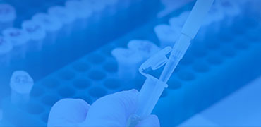 Antibodies for immune assay