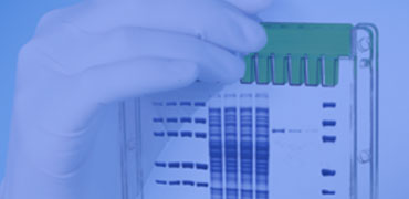 Hign Quality ExpressPlus PAGE Gels