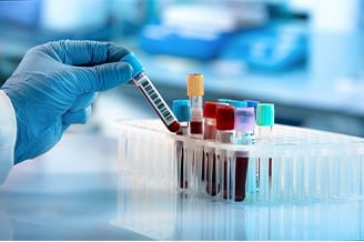 Should You Consider Other Cas Protein Options?